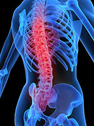 Types of spine diseases and surgery